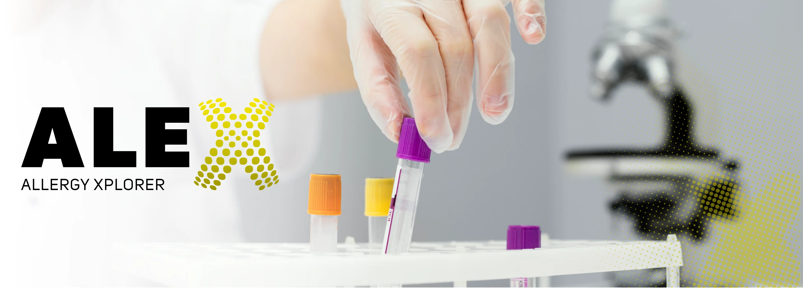 Pruebas de alergia en laboratorio