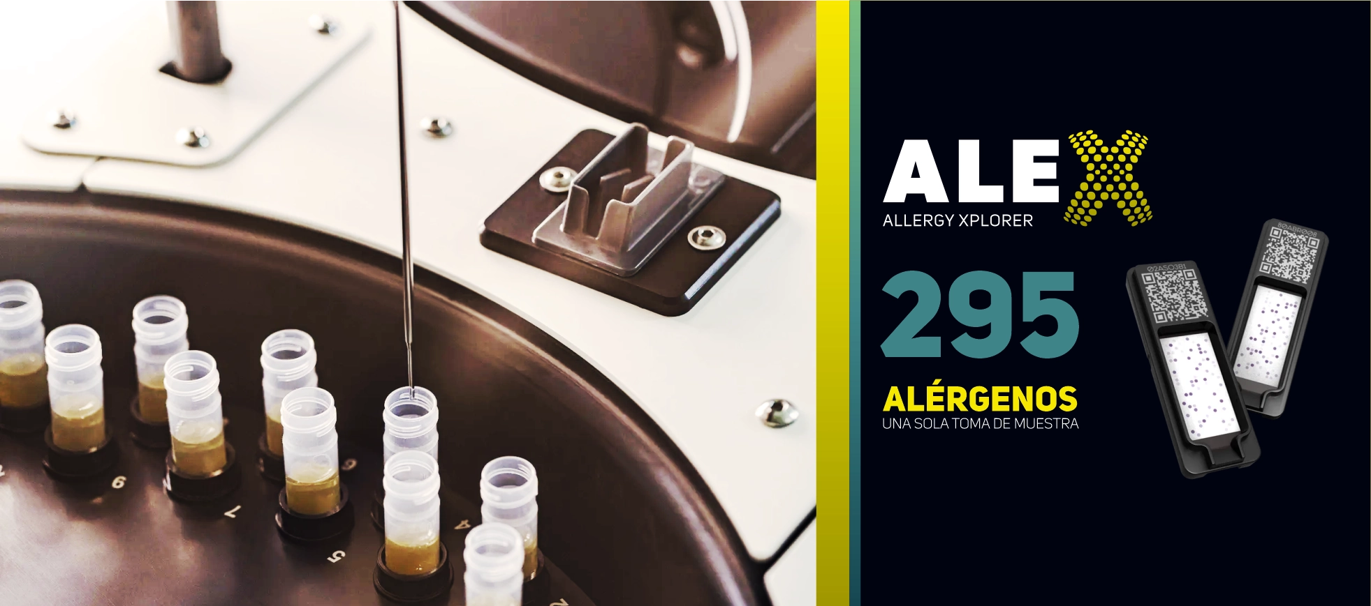 Tecnología moderna para pruebas de alergia en León